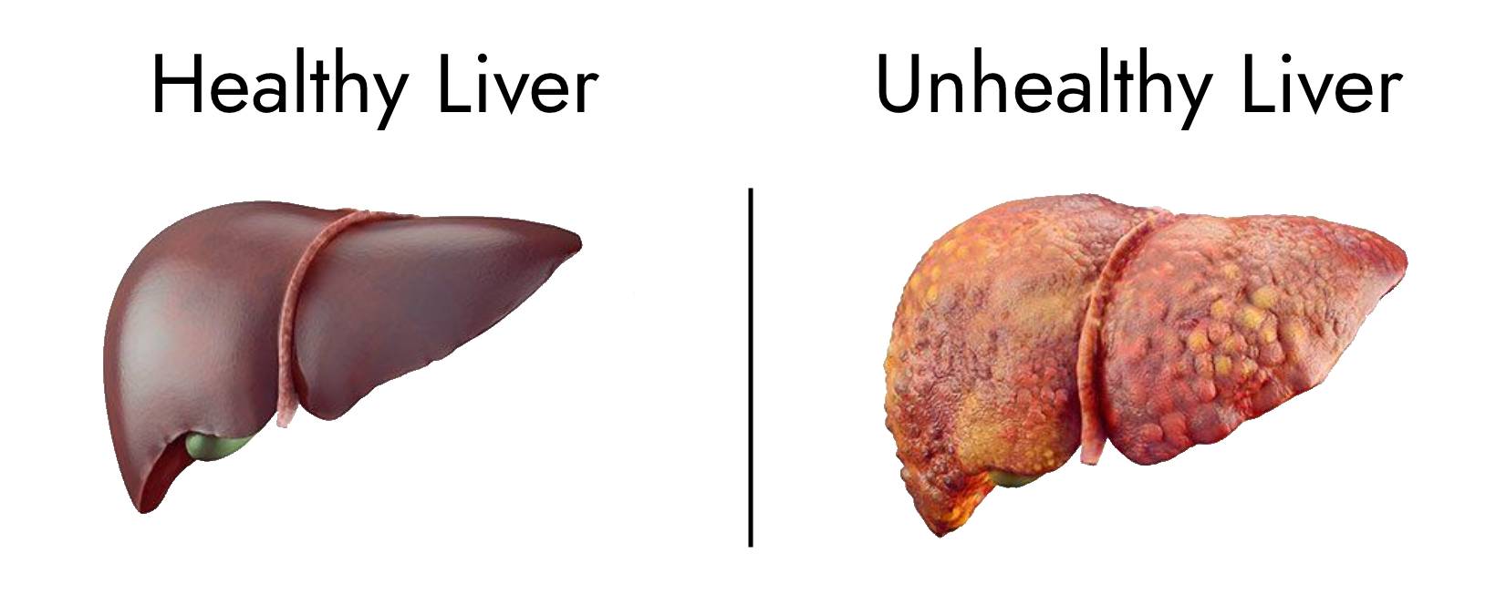 healthy-and-unhealthy-liver